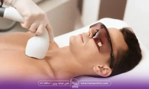 اپراتور لیزر که درحال لیزرسینه مردی که روی تخت خوابیده