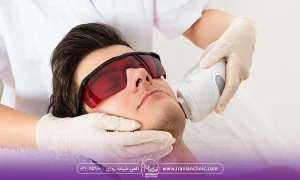 What happens if the interval between laser sessions increases