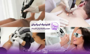 4 عکس مربوط به لیزر روی کتف مرد و لیزر روی پاهای زن و لیزر زیر بغل زن و لیزر روی دست زن
