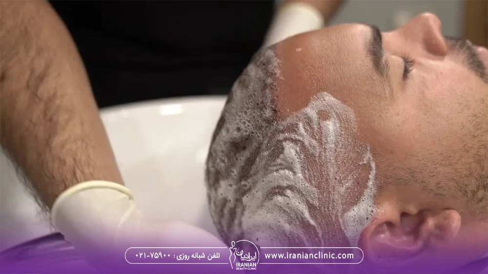 فردی که سر مردی که کاشت مو انجام داده را می شوید