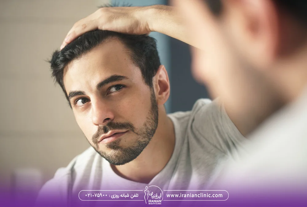 مرد جوان که ریزش مو دارد و موهای خود را در آینه می بیند - درمان ریزش مو هورمونی