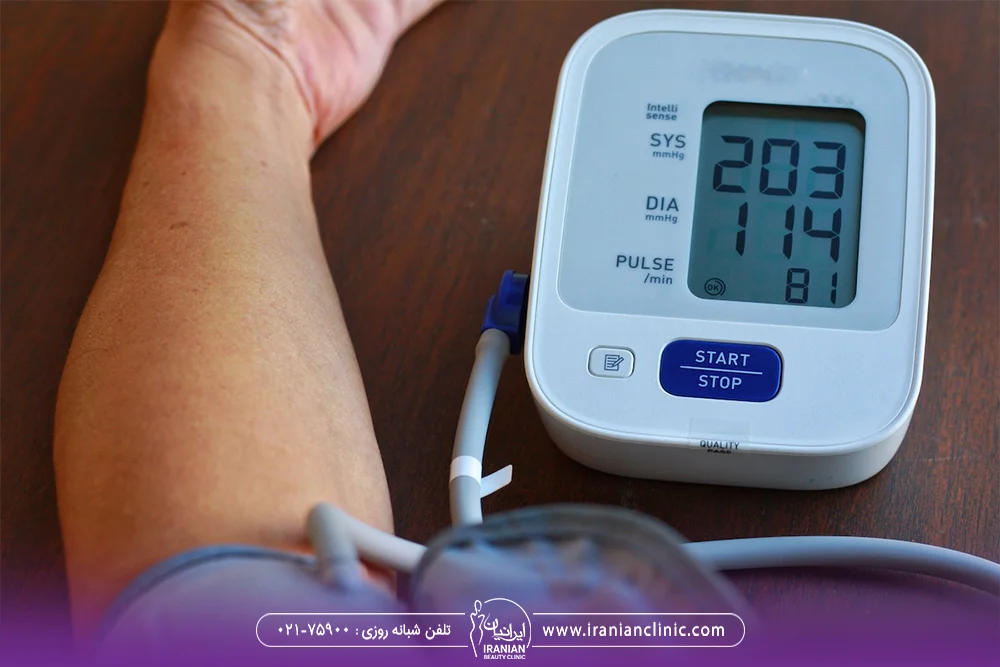 دستگاه تست فشار خون که به دست فرد بسته شده است - آزمایشات لازم قبل از کاشت مو