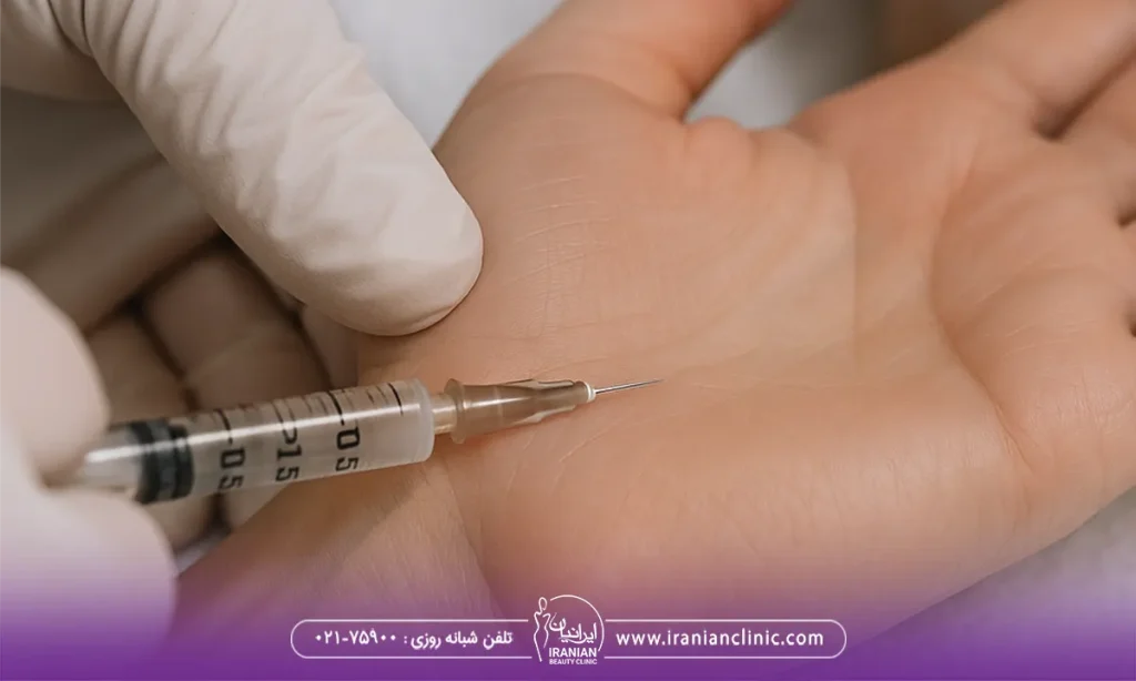 بوتاکس کف دست