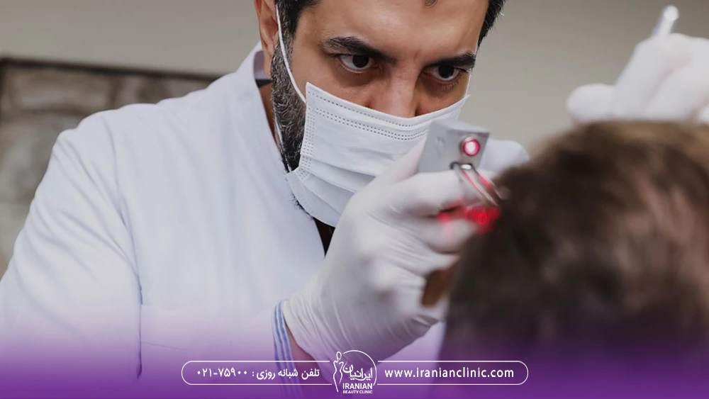 متخصص کاشت مو که روپوش سفید به تن دارد در حال کاشت مو روی سر مرد - بهترین کلینیک کاشت مو در تهران