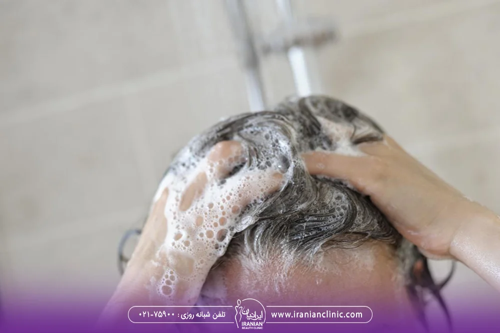 زن در حال شستن موهای خود - میکرونیدلینگ مو