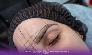 عکس زن قبل از کاشت ابرو
