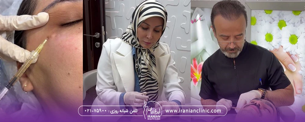 دو نفر از پزشکان کلینیک زیبایی ایرانیان در حال پی آر پی صورت و مراجعه کننده ای که گوشه چشم او prp می شود