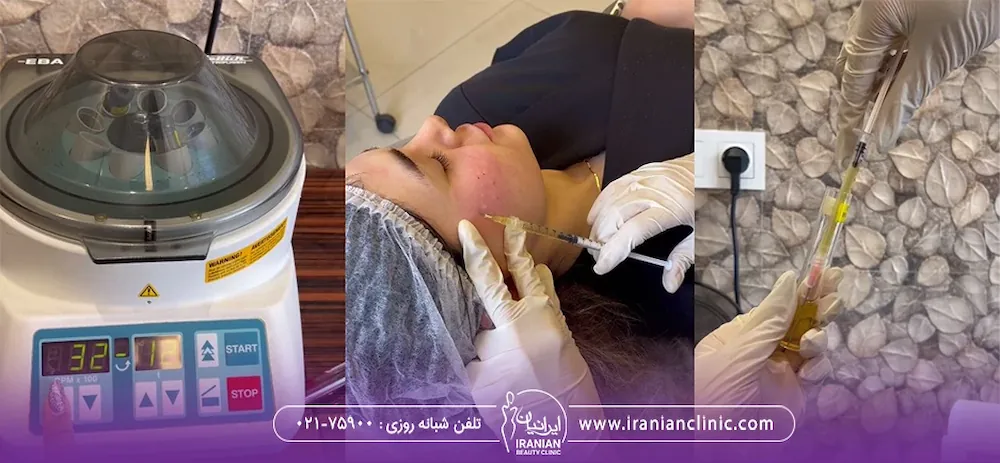 تصاویر از تزریق مزوتراپی و دستگاه های کلینیک زیبایی ایرانیان - پی آر پی صورت