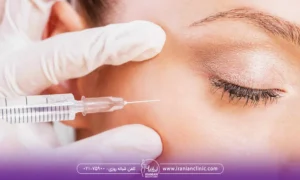 تزریق فیلر یا مزوژل به اطراف چشم زن توسط پزشک