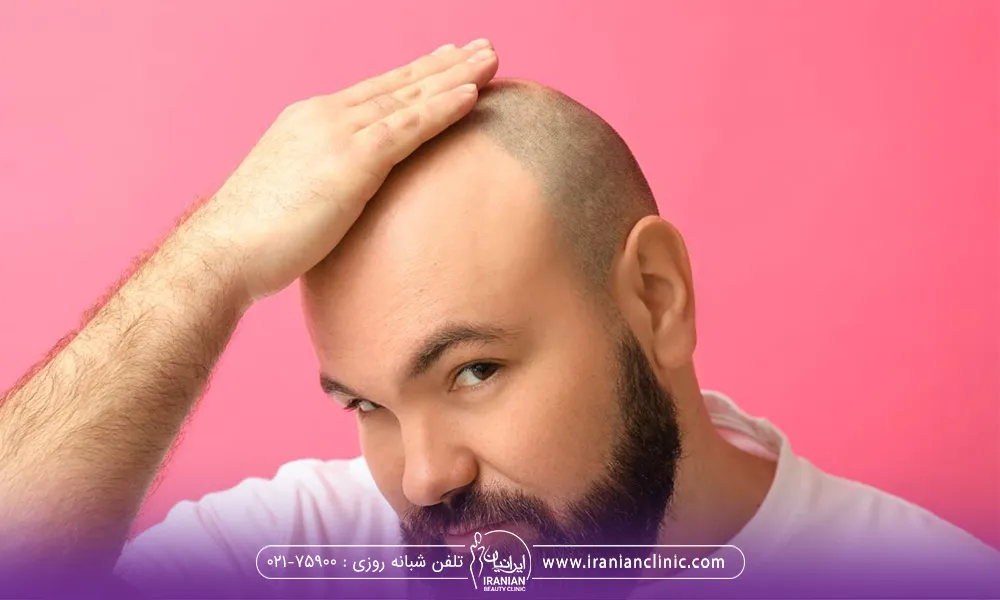 یک آقا که یک دستش را روی سر کچلش میکشد