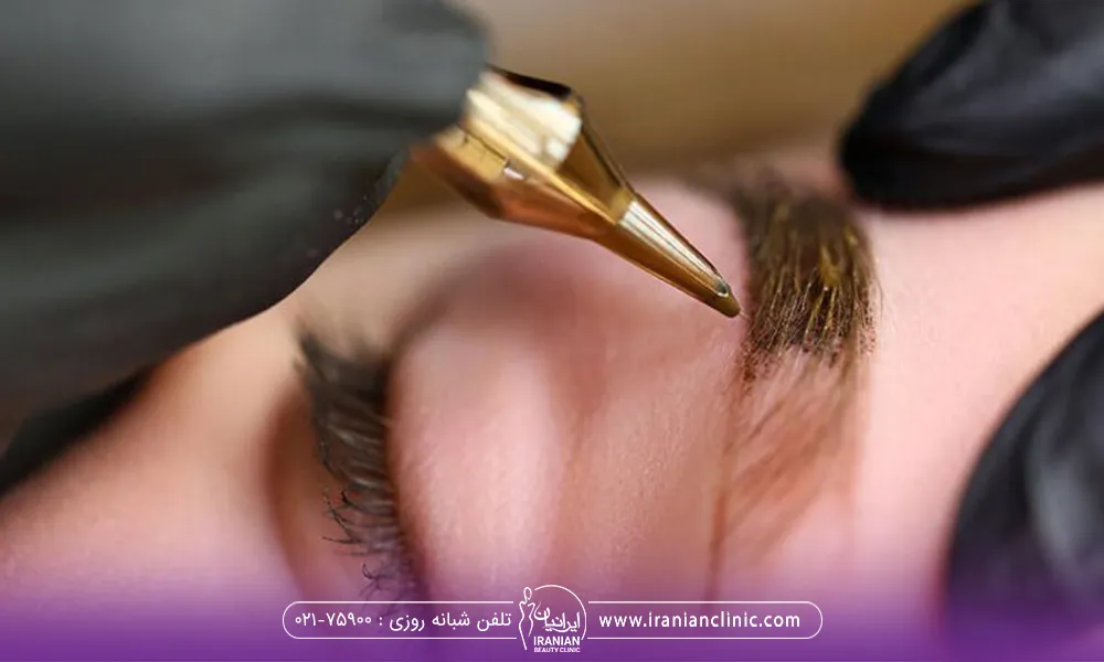 فردب که برای ریمو تاتو خود به کلینیک مراجعه کرده و در حال انجام کار است
