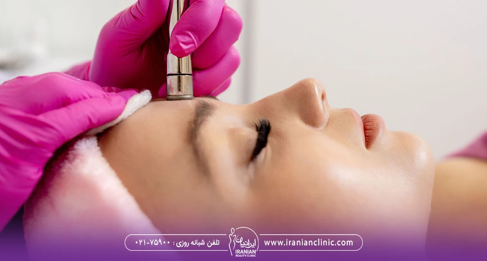 پزشک در حال انجام میکرودرم ابریژن روی پیشانی زن