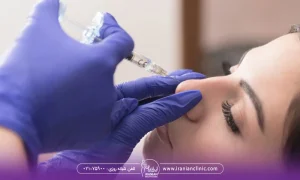 تصویر نیمه صورت است که مربوط به یک خانم است که چشماهایش بسته است و دست های دکتر که دستکش لاتکس آبی پوشیده و سرنگ فیلر ی که نزدیک بینی و در حال تزریق فیلر بینی است- مراقبت های بعد از فیلر بینی