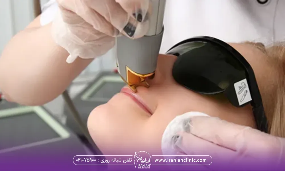 اپراتوری که در حال لیزر کردن بینی یک خانم است