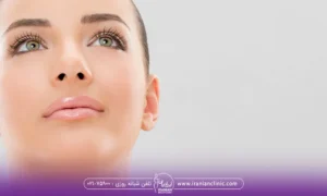 Durability of face PRP