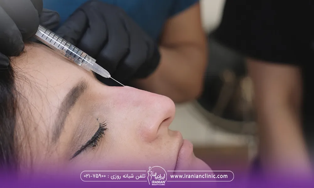 انجام تزریق فیلر روی بینی یک خانم توسط پزشک