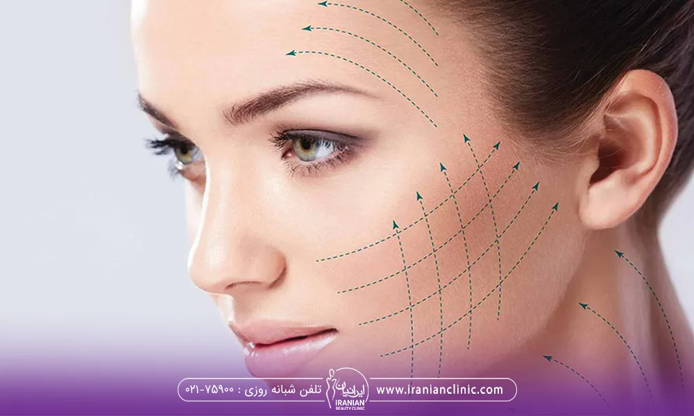چگونه بهترین دکتر زاویه سازی صورت را انتخاب کنم , ومشخص کردن خطوط زاویه سازی روی صورت خانم جوان