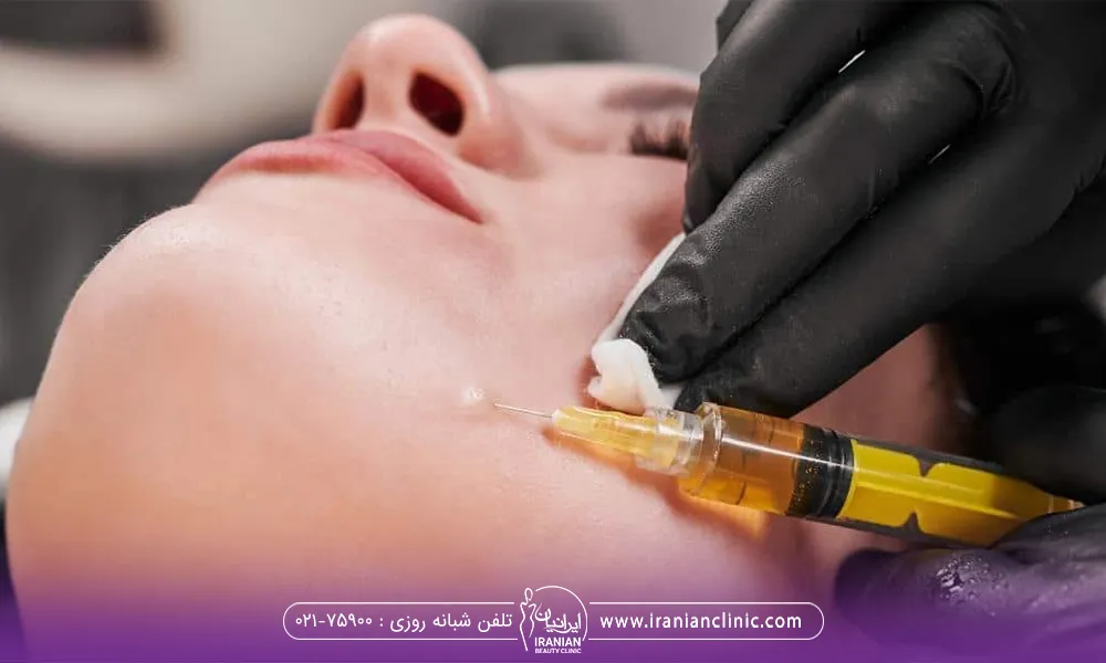 پزشکی که در حال تزریق prp برای یک فرد میباشد