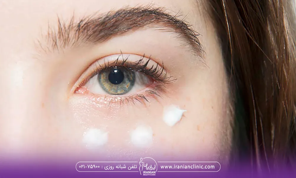 یک خانم جوان که زیر چشم خودرا به صورت نقطه ای کرم زده است