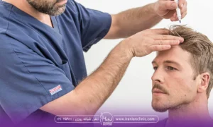 یک اقا به پزشک مراجعه کرده است برای کاشت مو میکروفیت