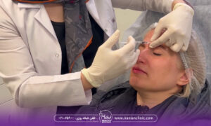عوارض بوتاکس