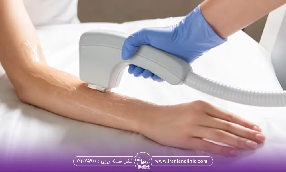 اپراتوری که در حال لیزر کردن دست یک فرد است و دستگاه را روی دست طرف مقابل است