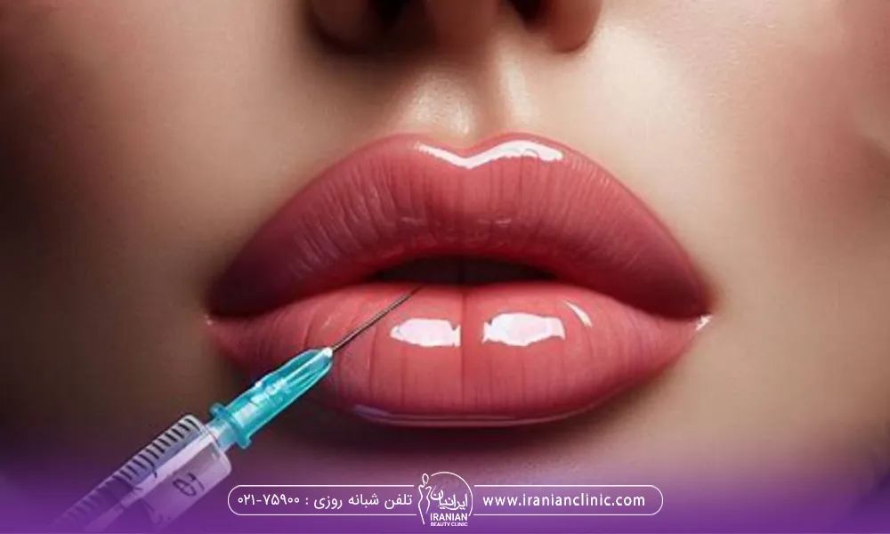 خانمی که برای گرد کردن لب هایش تزریق ژل انجام میدهد