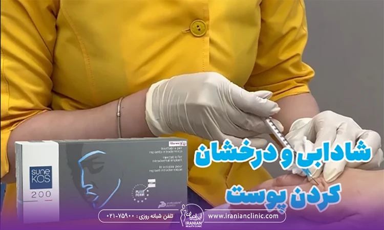 کاور ویدیو تزریق مزوژل سونه کاس
