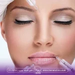 Botox injection cost