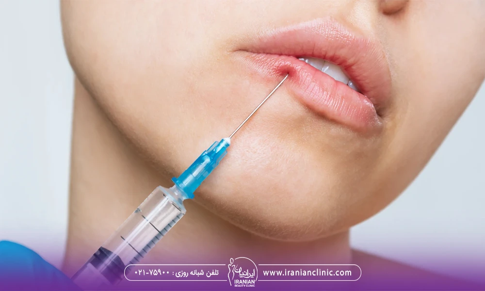 دچار شدن خانم جوان به ایسکمی بعد از تزریق ژل
