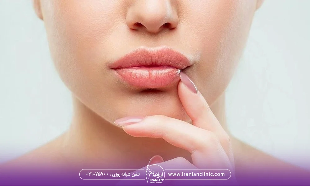 دختری که لب های خود را بعد از تزریق لب ماساژ میدهد - ماساژ لب بعد از تزریق ژل