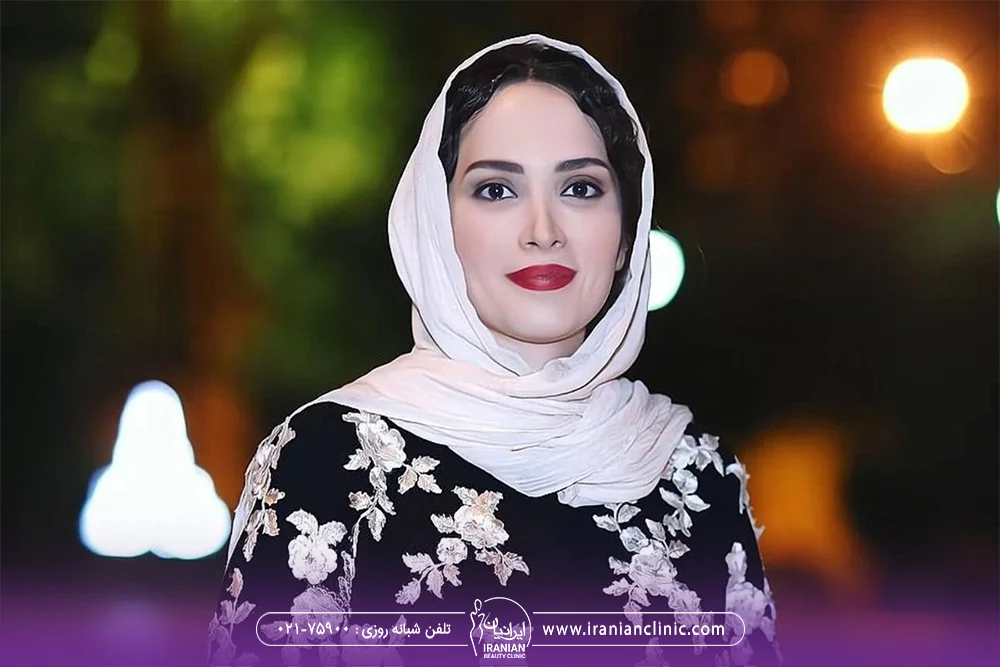 بهنوش طباطبایی با مانتو گل دار و شال سفید