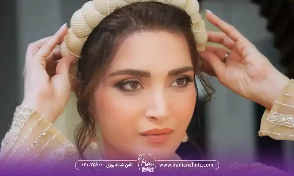 عمل چشم گربه ای بهنوش طباطبایی