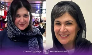 عکس از ریما رامین فر قبل و بعد از رژیم - لاغری ریما رامین فر