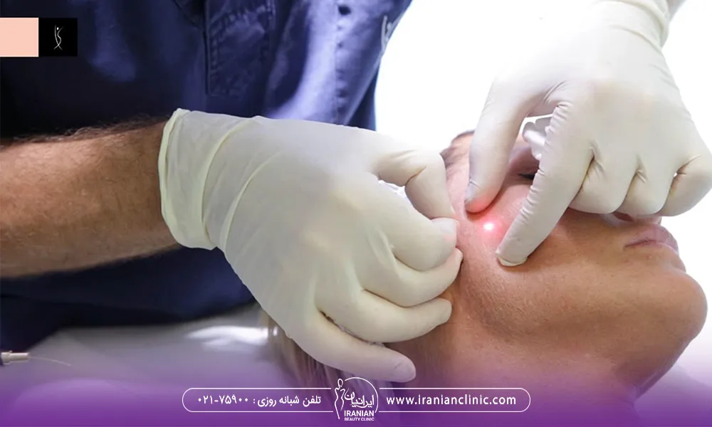 پزشک که دستکش سفید در دست کرده است در حال انجان اندولیفت در ناحیه گونه یک خانم است