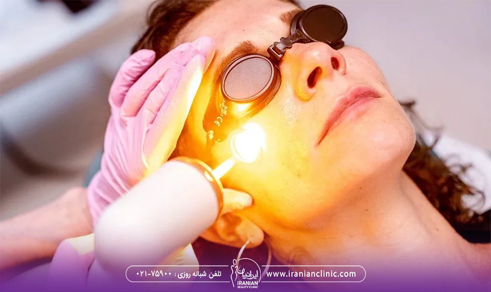 پزشکی که با اشعه دستگاه Advatx صورت زن را لیزر می کند