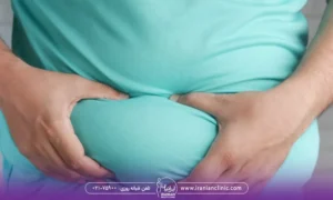 مرد چاقی که لباس سبز پوشیده و با دو تا دستش شکمش رو از دو طرف گرفته و به چاقی شکمش اشاره می کند.