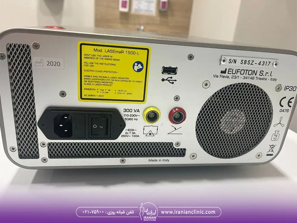 تصویر از پشت دستگاه اندولیفت یوفوتون