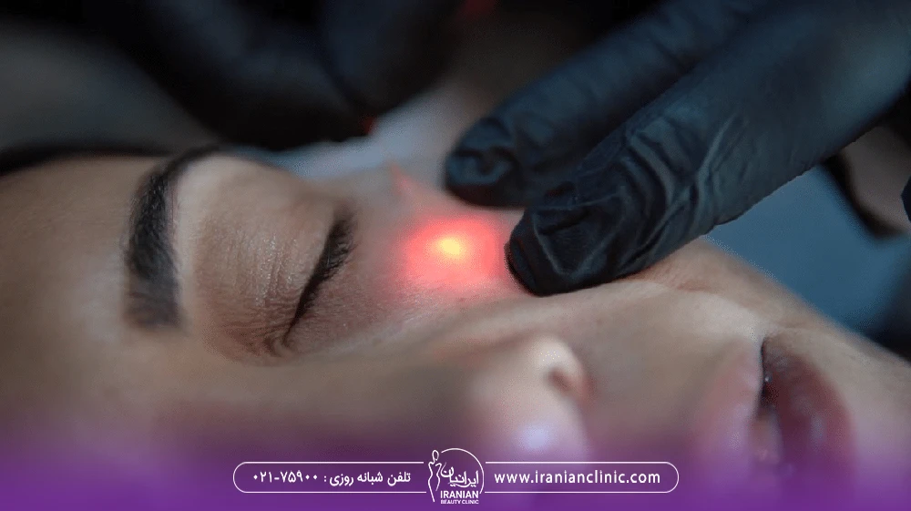 پزشکی که زیر چشم زن را اندولیفت می کند