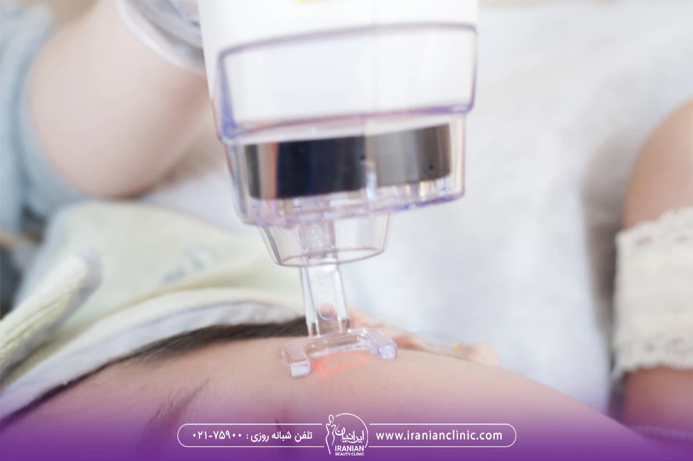 پزشکی که ناحیه شقیقه زن جوان را با دستگاه اج وان جوانسازی می کند