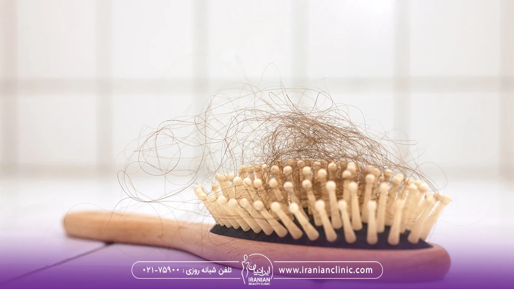 موهای ریخته که بعد از برس کشیدن داخل برس گیر کرده است