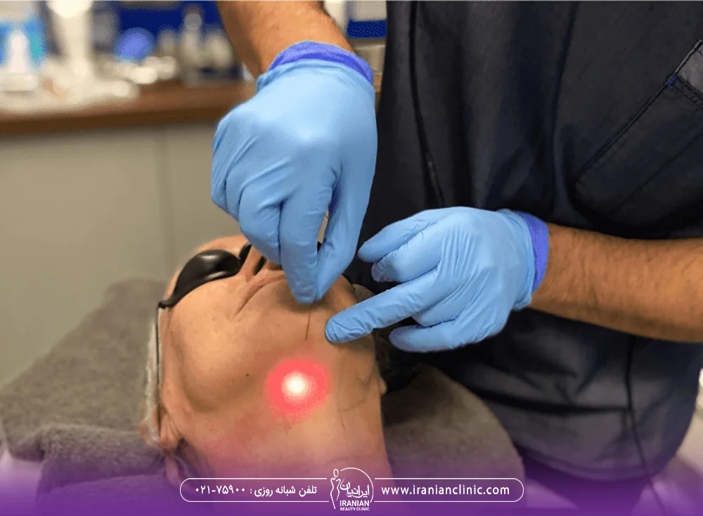 پزشک در حال اندولیفت زاویه فک زن مسن
