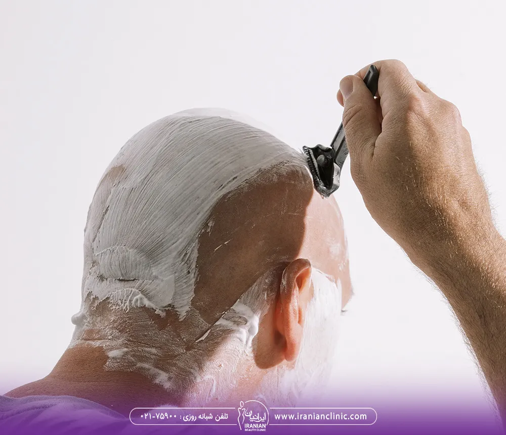 مرد در حال شیو سر خود با تیغ