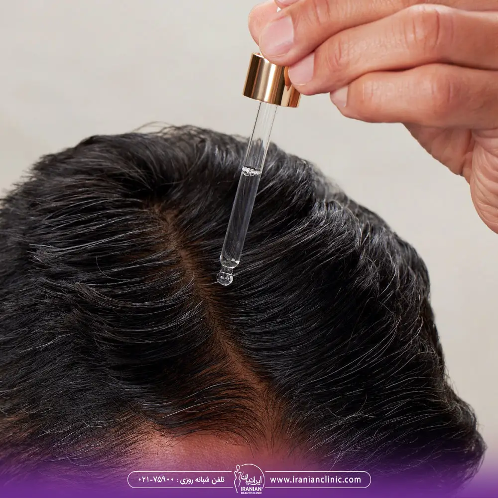 مردی که با قطره چکان روی موهای خود سرم مو می ریزد