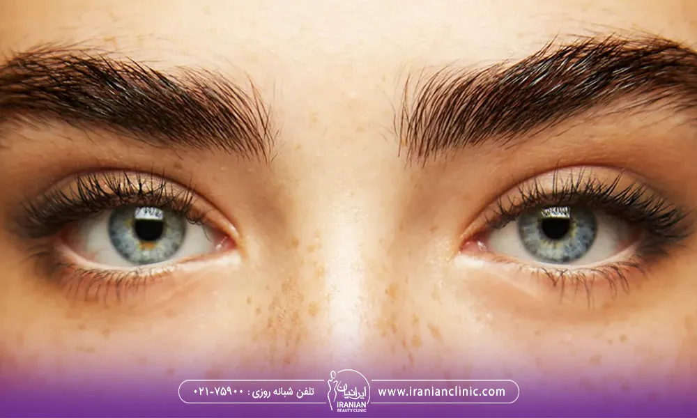 چشمای رنگی با ابروهای پهن که زیبایی را دو برابر کرده است.