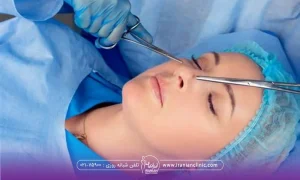 خانمی که بیهوش است و لباس مخصوص جراحی پوشیده است و دستان دکتر که در حال جراحی بینی است - مراقبت های بعد از عمل بینی