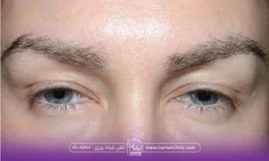 تصویر نزدیک از چشمان یک زن که ابروهای کم پشت و کوتاه دارد