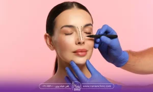 پزشکی در حال کشیدن خطوط روی بینی زیباجو