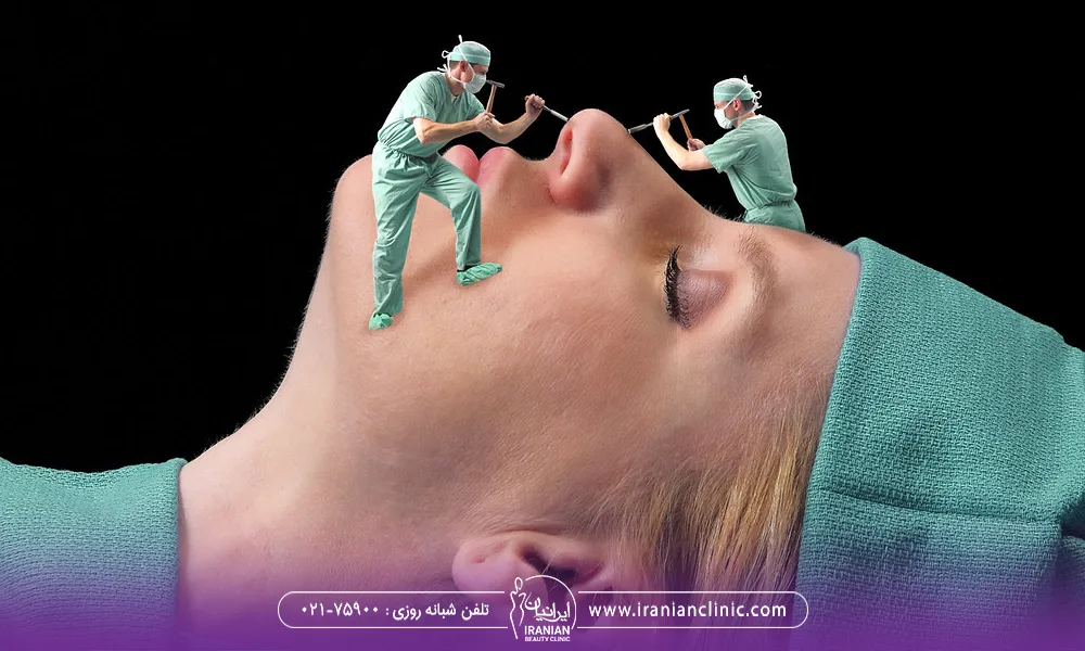 دکتر در حال جراحی بینی یک خانم می باشد | هزینه جراهی بینی