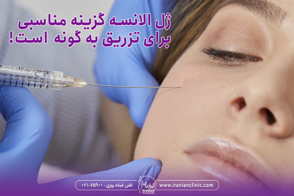 پزشکی که به گونه زن ژل الانسه تزریق می کند